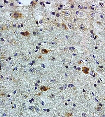 Anti-PACAP antibody used in IHC (Formalin-fixed paraffin-embedded sections). GTX37576
