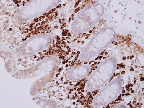 Anti-PACAP antibody [N1C3] used in IHC (Formalin-fixed paraffin-embedded sections). GTX106794