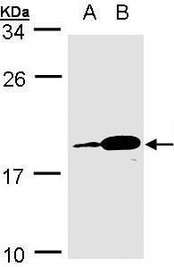 Anti-PACAP antibody [N1C3] used in Western blot. GTX106794