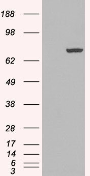 Anti-PAD4 / PADI4 antibody, N-term used in Western blot. GTX89631