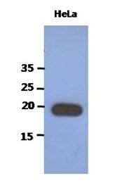 Anti-PAIP2 antibody [AT1C12] used in Western blot. GTX53755