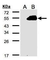 Anti-PAMCI antibody [C3], C-term used in Western blot. GTX106375