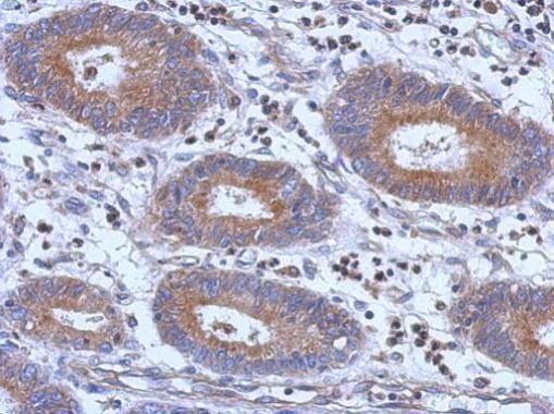 Anti-PARP11 antibody used in IHC (Formalin-fixed paraffin-embedded sections). GTX107210