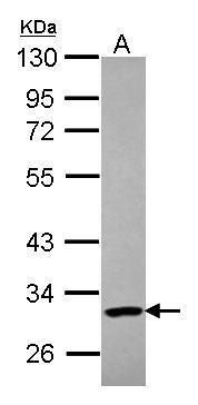 Anti-PARP11 antibody used in Western blot. GTX107210