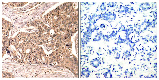Anti-Paxillin (phospho Tyr118) antibody used in IHC (Formalin-fixed paraffin-embedded sections). GTX50155