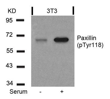 Anti-Paxillin (phospho Tyr118) antibody used in Western blot. GTX50155