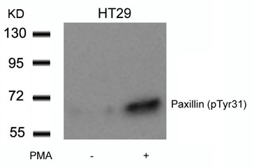 Anti-Paxillin (phospho Tyr31) antibody used in Western blot. GTX50243