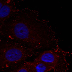 Anti-Paxillin (phospho Tyr88) antibody used in ICC/IF. GTX50350