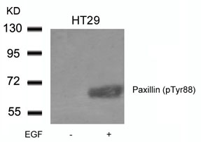 Anti-Paxillin (phospho Tyr88) antibody used in Western blot. GTX50350