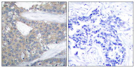 Anti-Paxillin antibody used in IHC (Formalin-fixed paraffin-embedded sections). GTX50528
