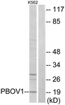 Anti-PBOV1 antibody used in Western blot. GTX87880