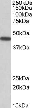 Anti-PBX1 antibody, Internal used in Western blot. GTX88088