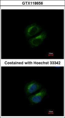 Anti-PCBP3 antibody [N1C2] used in ICC/IF. GTX118656