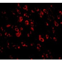 Anti-PCDH18 antibody used in ICC/IF. GTX85299
