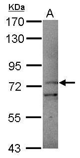 Anti-PCDHB11 antibody [N1N2], N-term used in Western blot. GTX119185