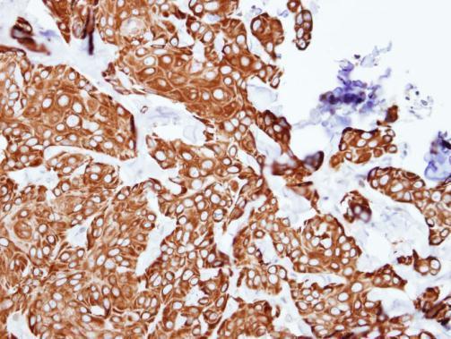 Anti-PCID1 antibody [C2C3], C-term used in IHC (Formalin-fixed paraffin-embedded sections). GTX106405