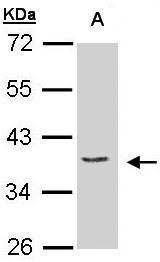 Anti-PCID1 antibody [C2C3], C-term used in Western blot. GTX106405