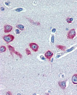 Anti-PCK1 / PEPCKC antibody, Internal used in IHC (Formalin-fixed paraffin-embedded sections). GTX89406