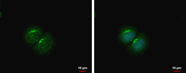 Anti-PCOLCE2 antibody used in ICC/IF. GTX103410