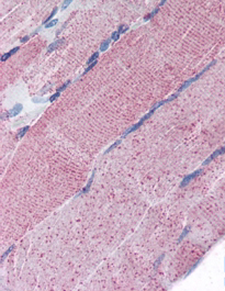 Anti-PCSK6 antibody, Internal used in IHC (Formalin-fixed paraffin-embedded sections). GTX88576