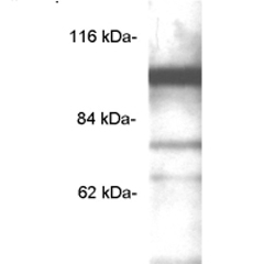 Anti-PDE6 alpha' antibody used in Western blot. GTX25660