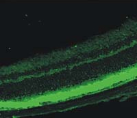 Anti-PDE6 beta antibody used in ICC/IF. GTX25663