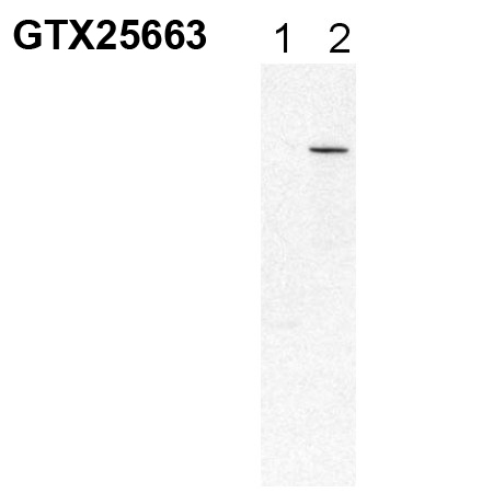 Anti-PDE6 beta antibody used in Western blot. GTX25663