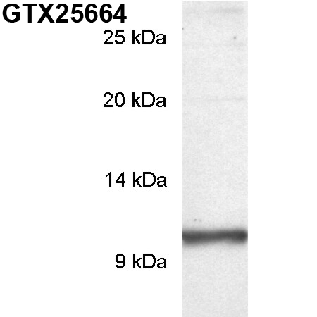 Anti-PDE6 gamma antibody used in Western blot. GTX25664