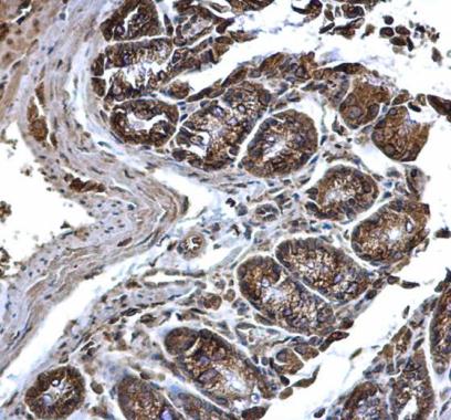 Anti-PDI antibody [N1N3] used in IHC (Formalin-fixed paraffin-embedded sections). GTX101468