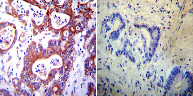 Anti-PDI antibody [RL77] used in Immunohistochemistry. GTX25484