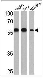Anti-PDI antibody [RL77] used in Western blot. GTX25484