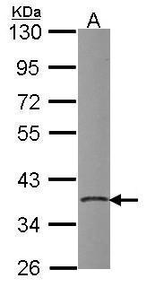 Anti-PDIK1L antibody [N1], N-term used in Western blot. GTX108313