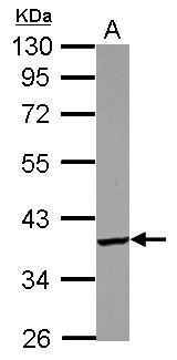 Anti-PDIK1L antibody [N2C3] used in Western blot. GTX122965