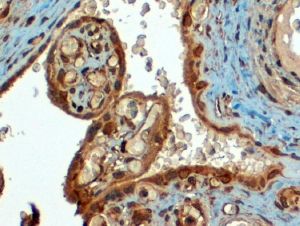 Anti-PD-L1 antibody, C-term used in IHC (Formalin-fixed paraffin-embedded sections). GTX89590