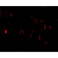 Anti-PDL-2 antibody used in ICC/IF. GTX85449