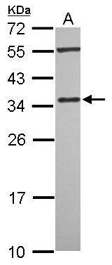 Anti-PDLIM4 antibody used in Western blot. GTX118281