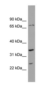 Anti-PDP2 antibody, Internal used in Western blot. GTX44906