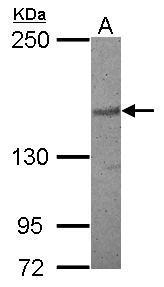Anti-PDS5B antibody [N1N2], N-term used in Western blot. GTX116345