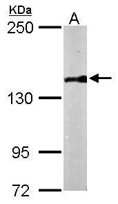 Anti-PDS5B antibody [N1N2], N-term used in Western blot. GTX116345