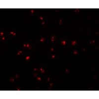 Anti-IFITM1 antibody used in ICC/IF. GTX85181