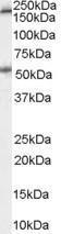 Anti-5-HT3A receptor antibody, Internal used in Western blot. GTX89260