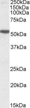 Anti-5-HT3B receptor antibody, Internal (near C-terminus) used in Western blot. GTX88391