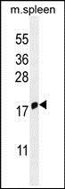 Anti-IFITM5 antibody used in Western blot. GTX53634