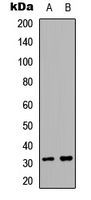 Anti-ACER2 antibody used in Western blot. GTX54882