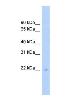 Anti-C16orf73 antibody, Internal used in Western blot. GTX45259