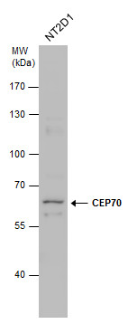 Anti-CEP70 antibody used in Western blot. GTX120594