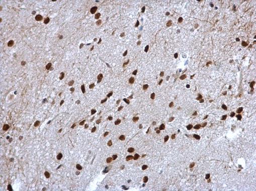Anti-Cyclin T2 antibody [C2C3], C-term used in IHC (Formalin-fixed paraffin-embedded sections). GTX111944