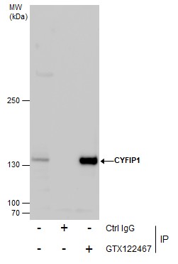 Anti-CYFIP1 antibody [N1N2], N-term used in Immunoprecipitation. GTX122467