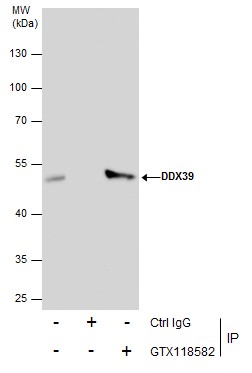 Anti-DDX39 antibody [C1C3] used in Immunoprecipitation. GTX118582