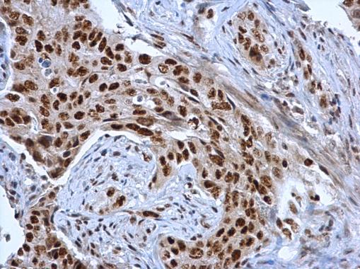 Anti-DDX39 antibody [C1C3] used in IHC (Formalin-fixed paraffin-embedded sections). GTX118582